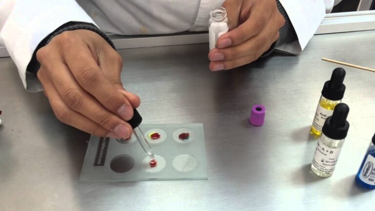 Cómo determinar tu grupo sanguíneo en Córdoba, Argentina