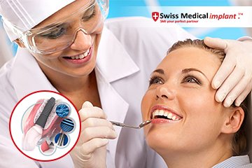Qué plan de Swiss Medical cubre implantes dentales